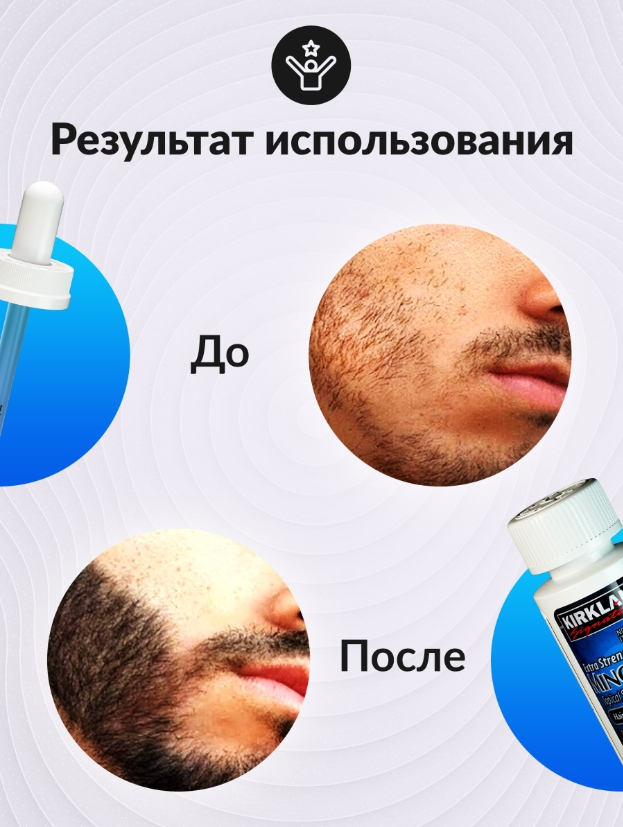 Миноксидил для роста бороды и волос Kirkland Minoxidil 5%, 60 мл купить ...