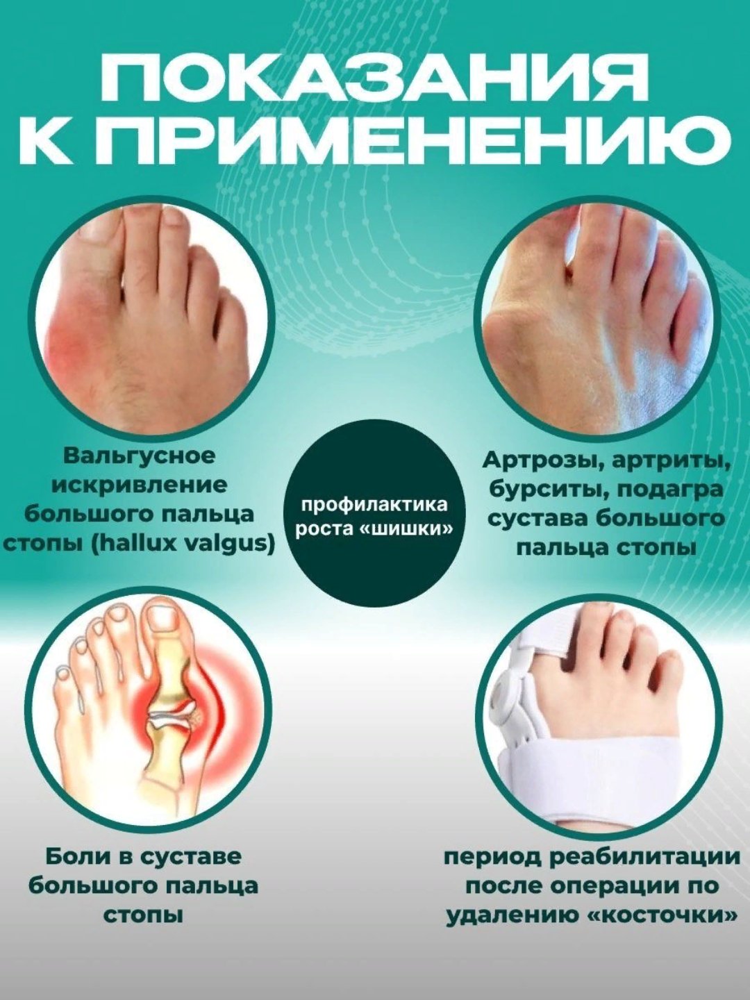 Корректор большого пальца ноги Hallux Valgus, 1 шт купить по низким ценам в  интернет-магазине Uzum (690667)