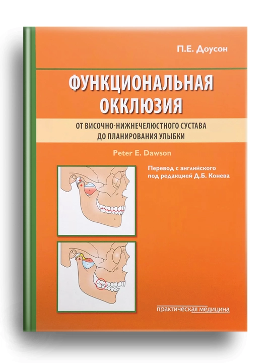 Функциональная окклюзия. От височно-нижнечелюстного сустава до планирования улыбки. Доусон - 