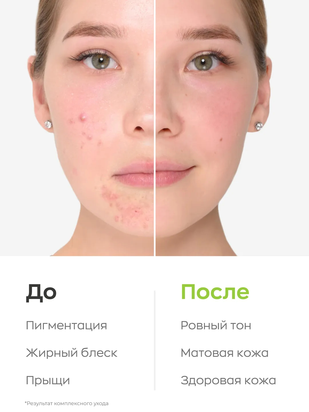 Тоник для лица с миндальной и молочной кислотой для проблемной и жирной ...