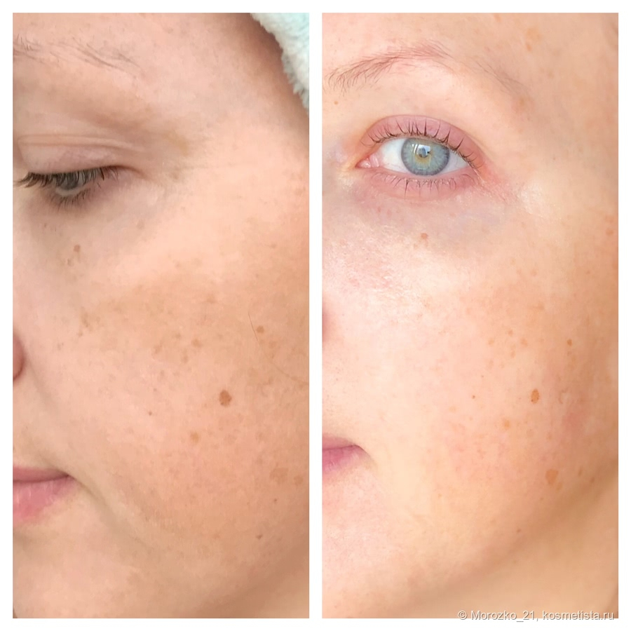 anti aging facial products - YouTube