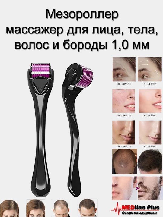 Мезороллер, массажер для лица, тела, волос и бороды, 1.0 мм