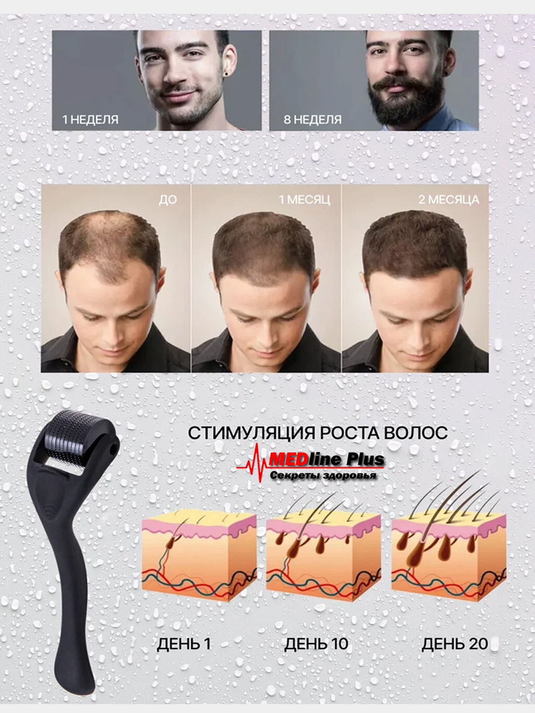 Мезороллер, массажер для лица, тела, волос и бороды, 1.0 мм