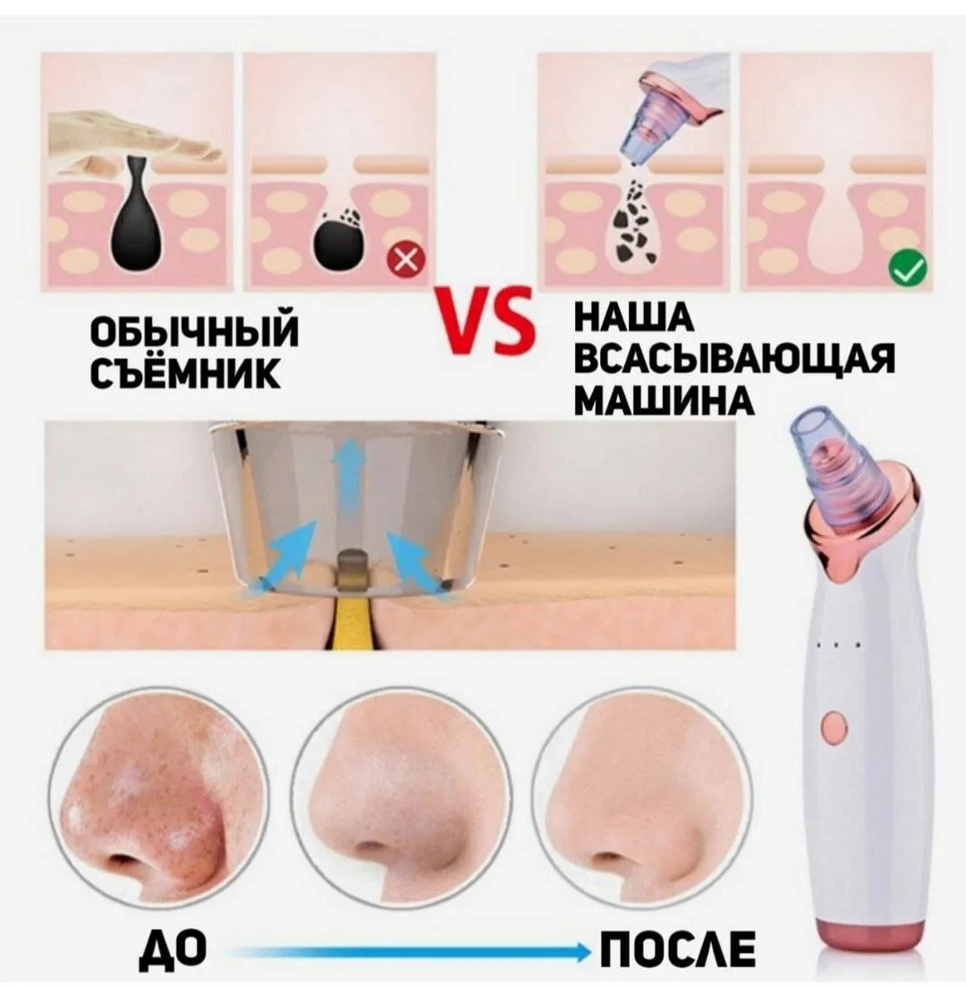 Вакуумный аппарат очиститель пор кожи, чистка лица от чёрных точек,массажер  антивозрастной купить по низким ценам в интернет-магазине Uzum (526790)