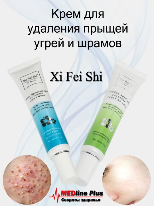 Ugri va akne chandiqlarni olib tashlash uchun krem, Xi Fei Shi, 35 g