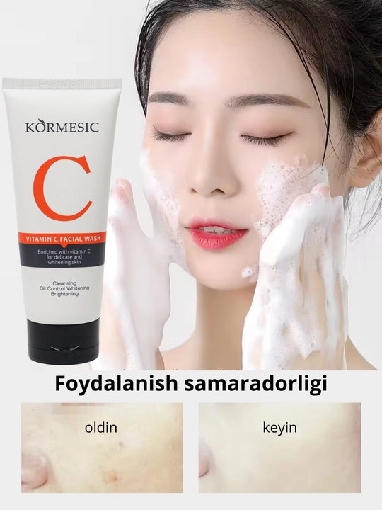 Yuz va bo'yin uchun sut gel, molochko vitamin C bilan, oqartuvchi, yosh dog'lariga qarshi