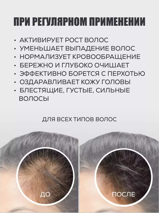 Лекарственное мыло против выпадении волос, утолщает и затемняет волосы, чёрное мыло, 100 г