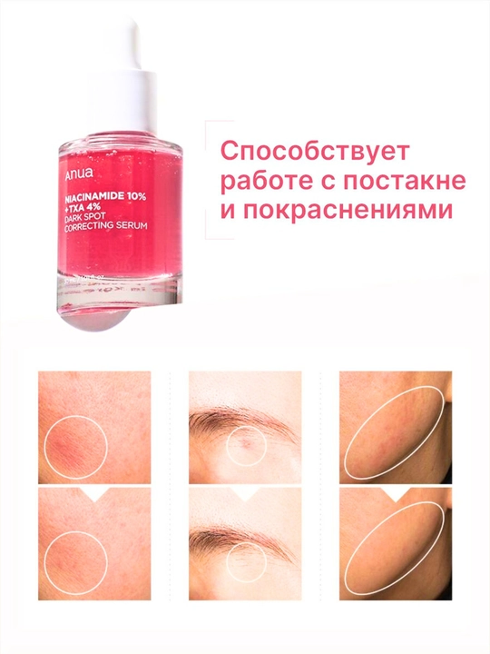 Niacinamide 10% + TXA 4% teng ohang uchun, qarishga qarshi zardob