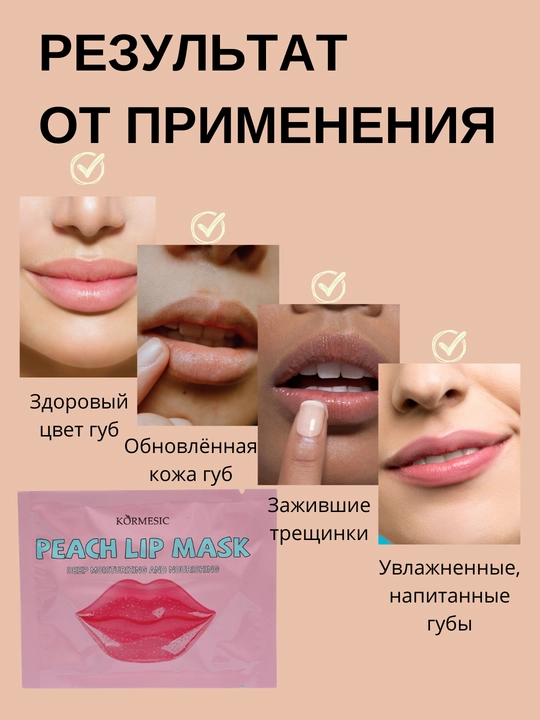Увлажняющие гидрогелевые патчи для губ Kormesic, питательная маска с витаминами