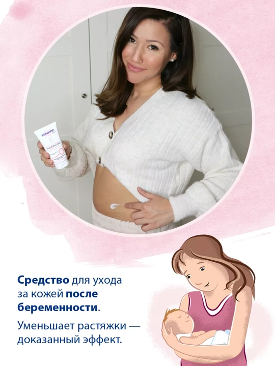 Sanosan Mama zardob kremi, cho'zish belgilari uchun, 75 ml