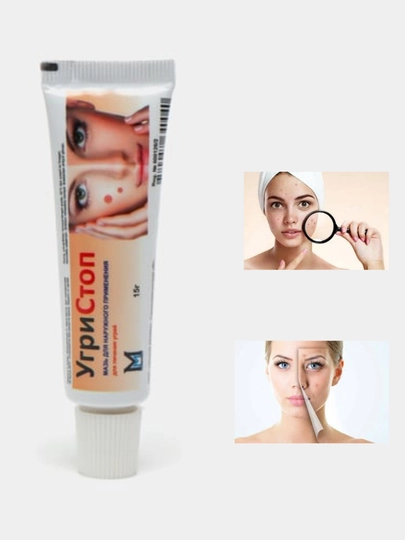 Крем Skinshine (15 г) — крем, устраняющий неравномерный тон кожи и пигментацию - 
