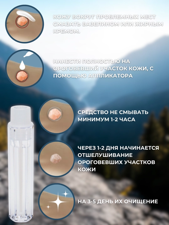 Средство против папилломы и бородавки Супер чистотело, косметическая жидкость, 3 мл
