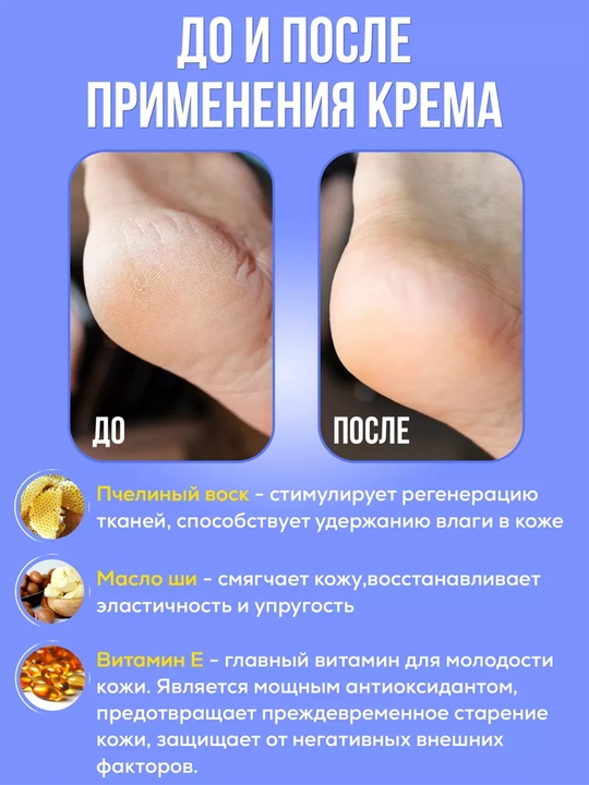 Крем стик от трещин и шелушений HIH, увлажняющий для сухой кожи