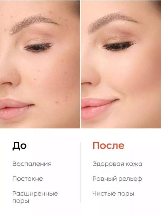 Энзимная пудра для умывания Likato, очищение черных точек, 120 г