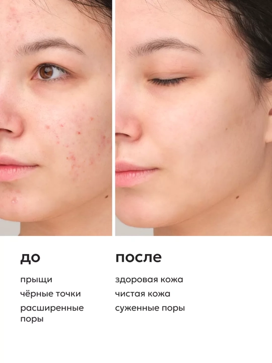 Пенка с ниацинамидом, цинком и салициловой кислотой, Likato professional, 150 мл