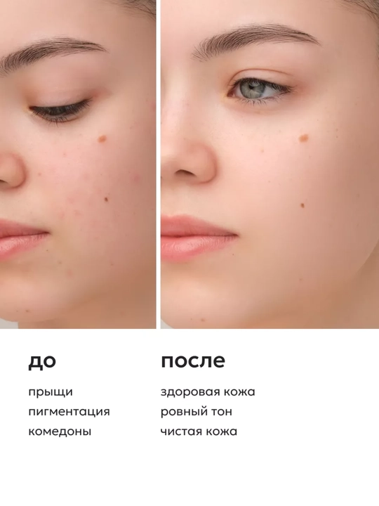 AHA+BPA 30%, 30 ml, STD bilan "LIKATO" professional ko'p kislotali yuzni tozalash