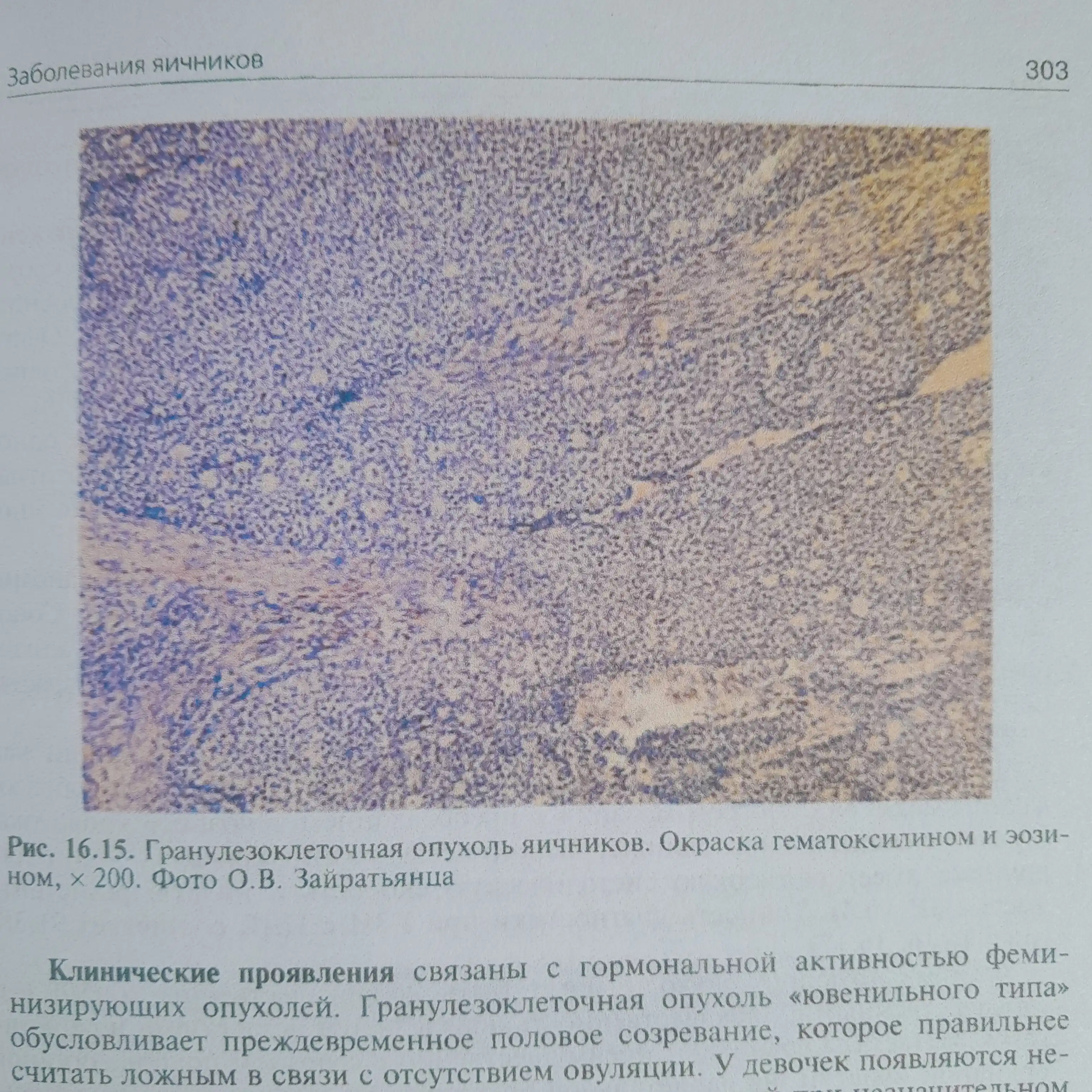 Гинекология: Учебник, 4-е издание, переработанное и дополненное