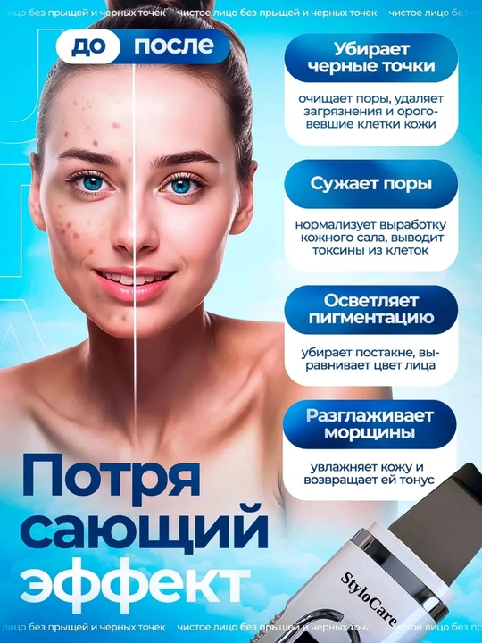Аппарат для ультразвуковой чистки лица, против черных точек