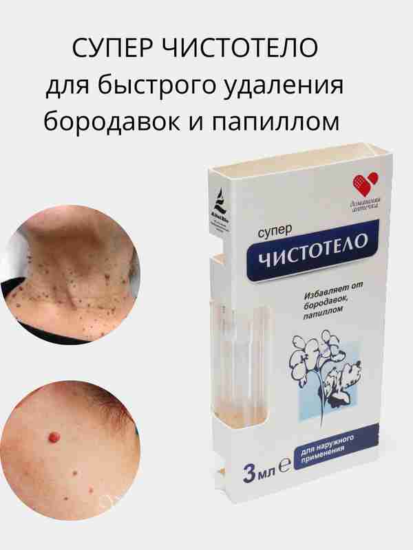 Xotiningiz eshakda beradi Viola Woodmanning kastingida