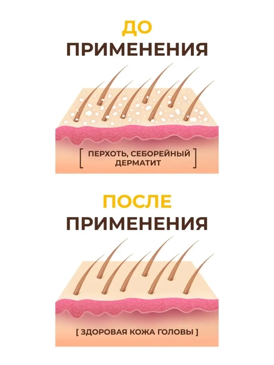 Шампунь против перхоти с Кетоконазолом, Лошадиная сила, для всех типов волос, 250 мл