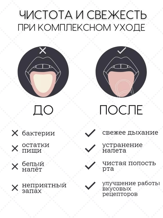 Tilni tozalash uchun qirg'ich cho'tkasi, metall, katta, tiltozalagich