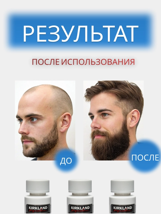 Миноксидил для роста бороды и волос Kirkland Minoxidil 5% 60 мл