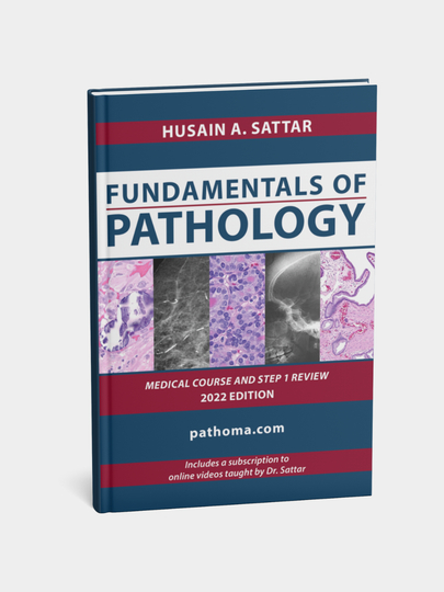 Fundamentals of Pathology by Hussain A,sattar. Pathoma - 