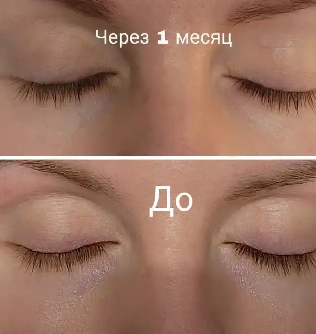Zardob kirpiklar va qoshlarni o'stirish va mustahkamlash uchun