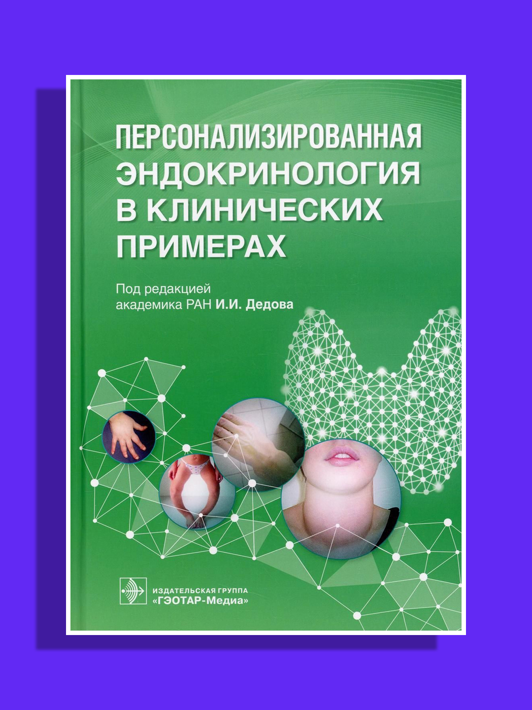 Персонализированная эндокринология в клинических примерах.Дедова И. И - 