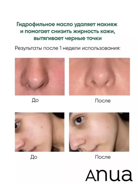 Gidrofil moy, Anua Heartleaf gzeneklarni nazorat qilish uchun tozalash moyi, 200 ml
