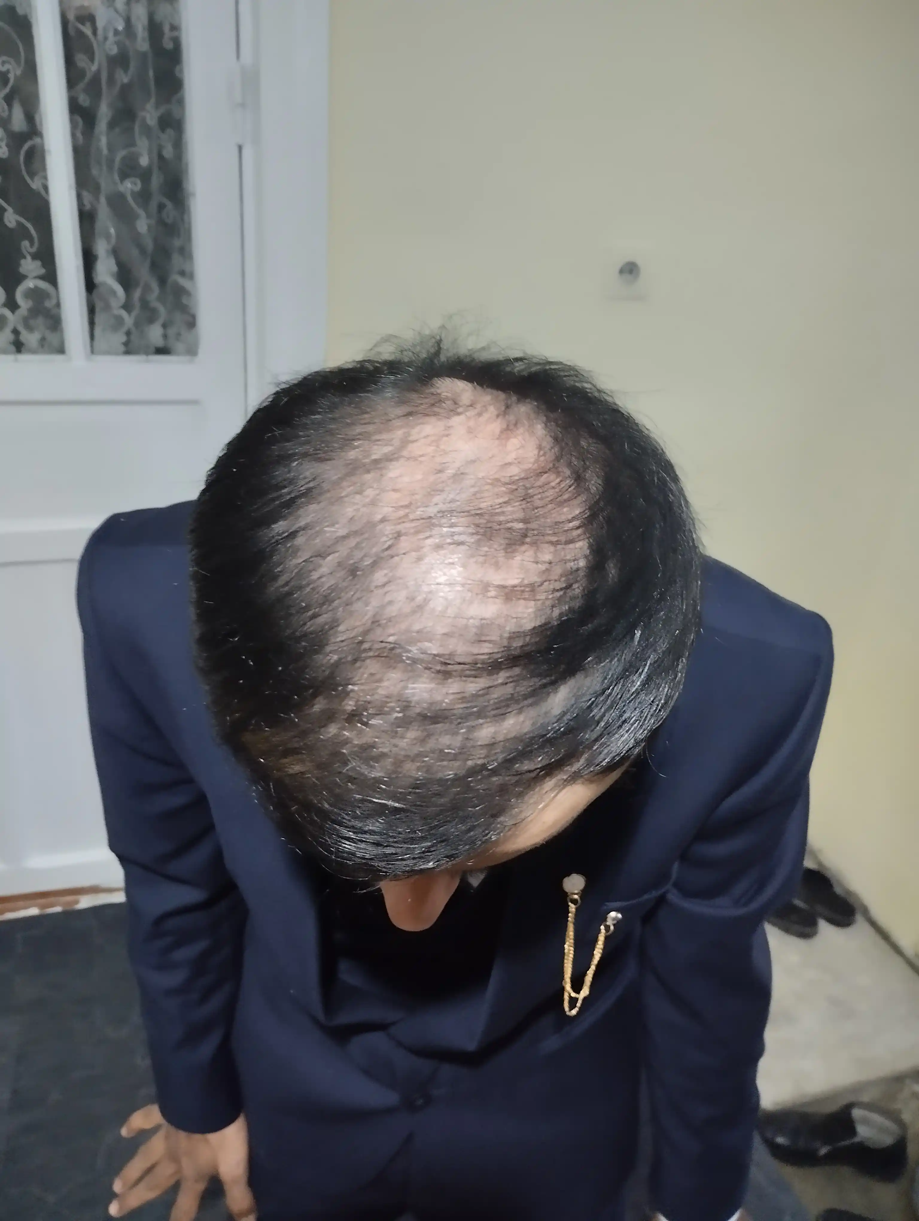 Пудра загуститель для волос Dexe Hair Building Fibers