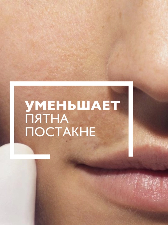 Сыворотка против пигментации, LA ROCHE-POSAY MELA B3, 30 мл