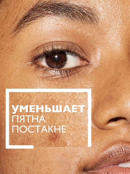 Сыворотка против пигментации, LA ROCHE-POSAY MELA B3, 30 мл