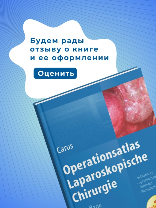Operationsatlas Laparoskopische Chirurgie 2014