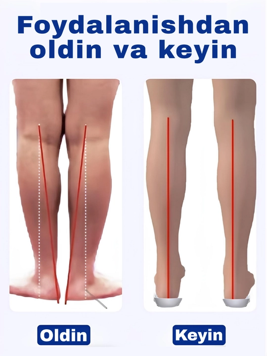 Ortopedik patak