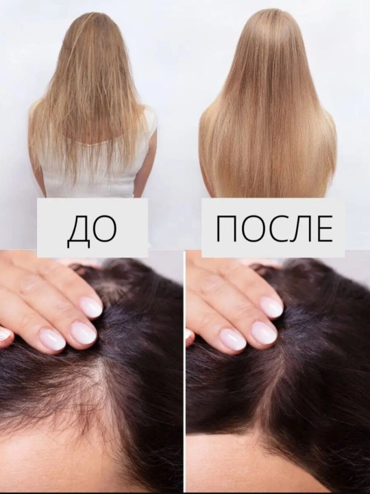 BIOXCIN сыворотка в ампулах, против выпадения волос