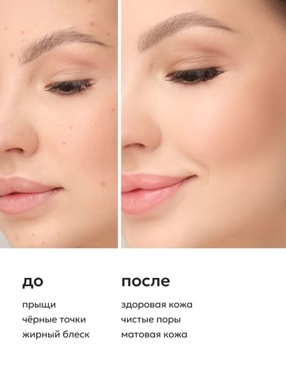 Набор для кожи Likato, гель AHA для умывания лица, энзимная пудра, от прыщей и акне
