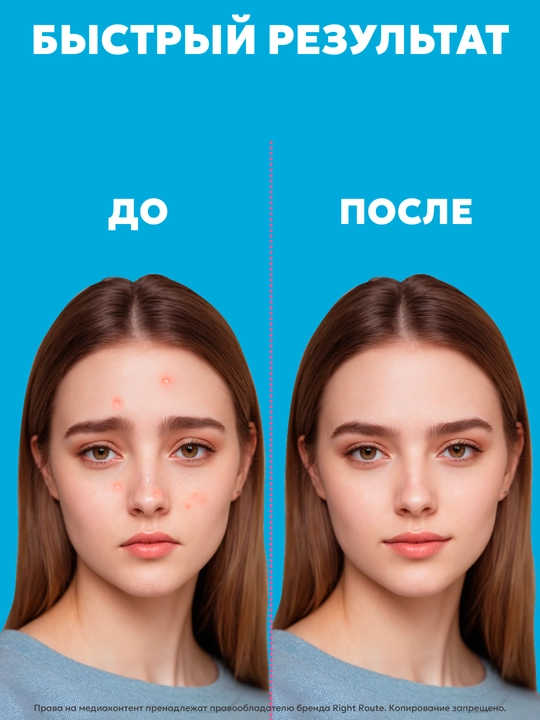 Патчи от черных точек, прыщей и акне, ультратонкие, из натуральных растений, 48 шт