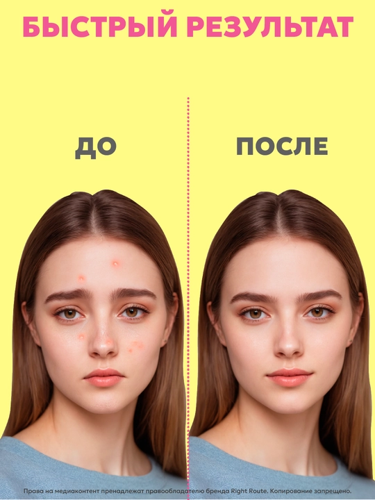 Косметические патчи, пластыри от прыщей и акне, гидроколлоидные, для проблемной кожи