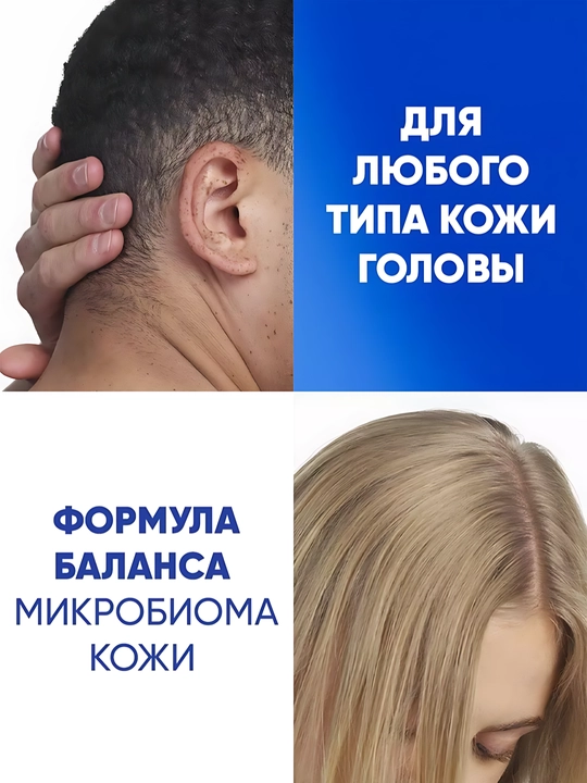 Head&Shoulders Шампунь от перхоти Цитрусовая свежесть для жирных волос, 200мл
