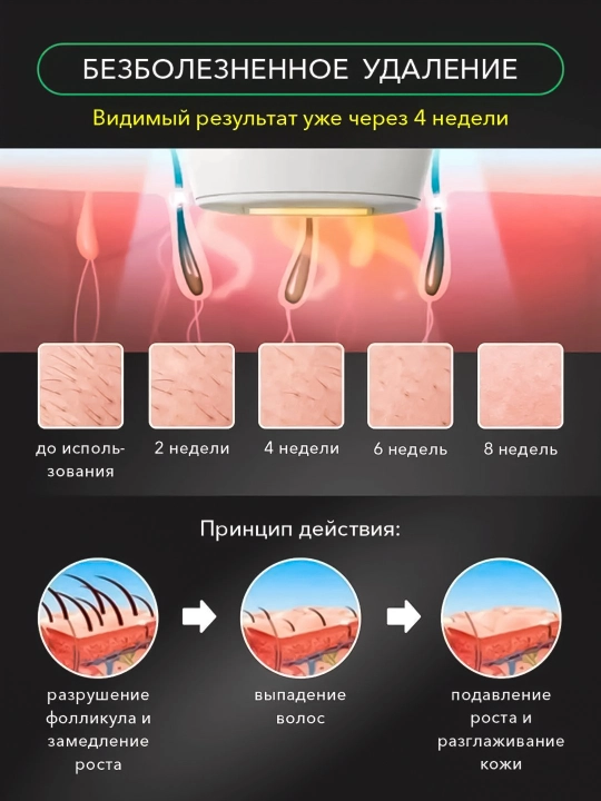 MAC Fotoepilyator lazerli, sovutish