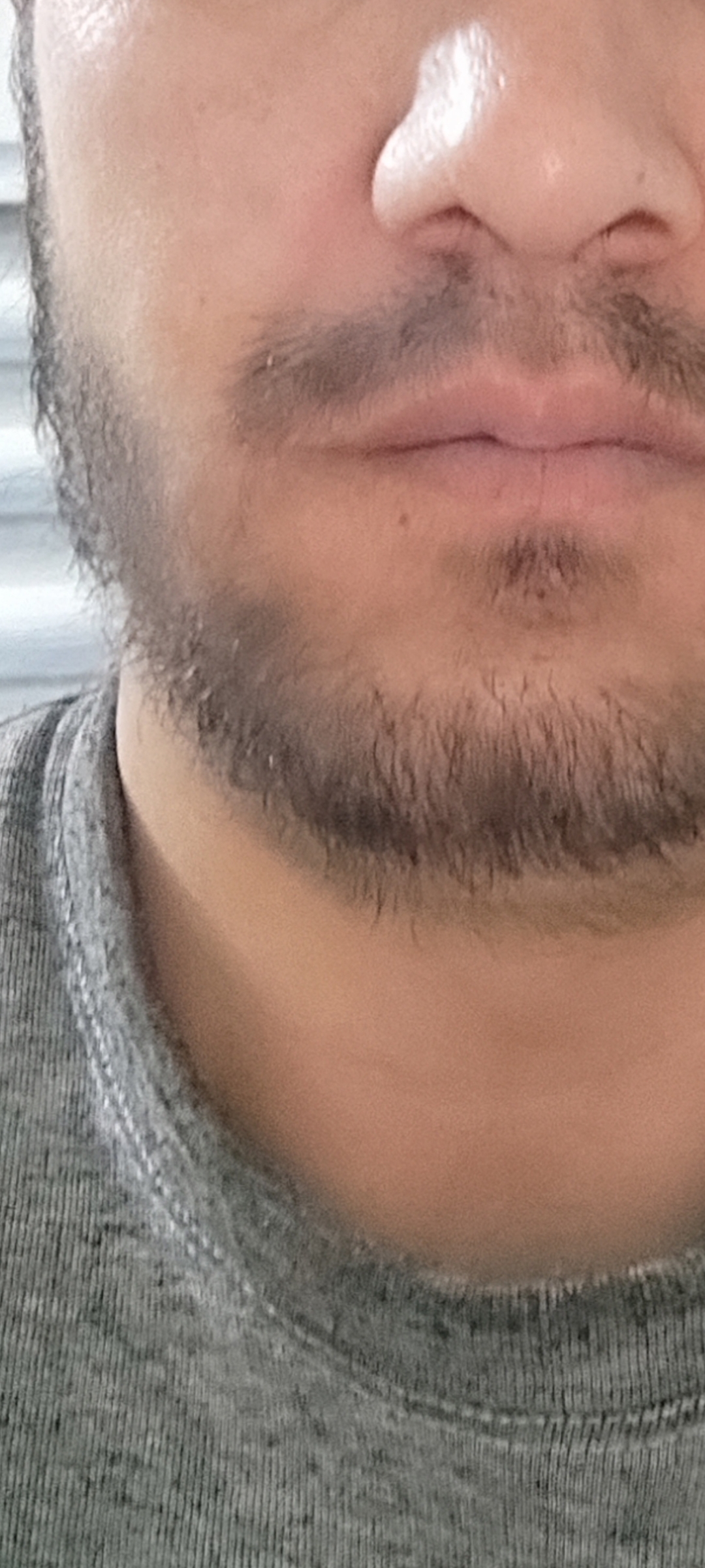 Soch va soqol o'stirish uchun minoksidil Minoxidil 10%, 60 ml