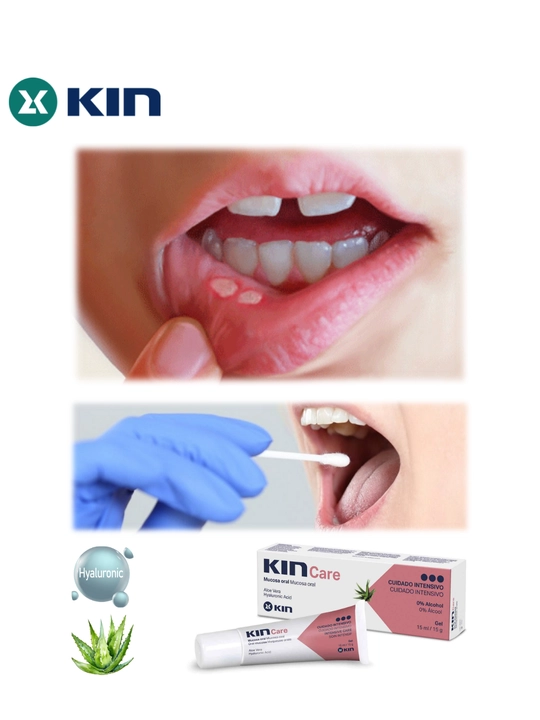 Гель KIN Care для ухода за слизистой рта, при стоматите, 15 мл, 0.24%