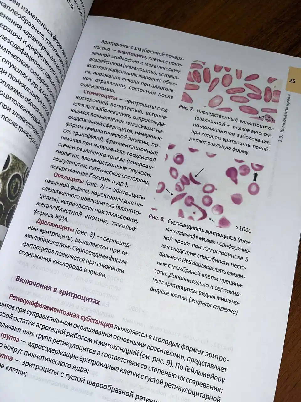 Gematologicheskiy Atlas, Nastolnoye Rukovodstvo Vracha-Laboranta: Atlas po gematologii