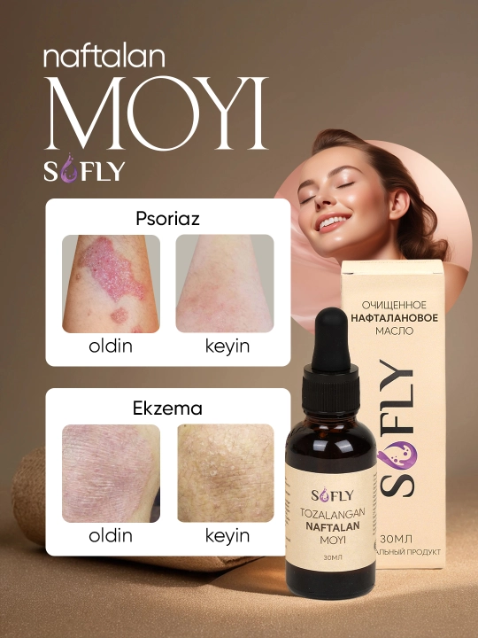 Naftalan moyi SOFLY, 30 ml, teri va bo‘g‘imlar uchun tabiiy vosita