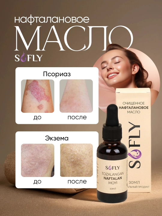 Naftalan moyi SOFLY, 30 ml, teri va bo‘g‘imlar uchun tabiiy vosita