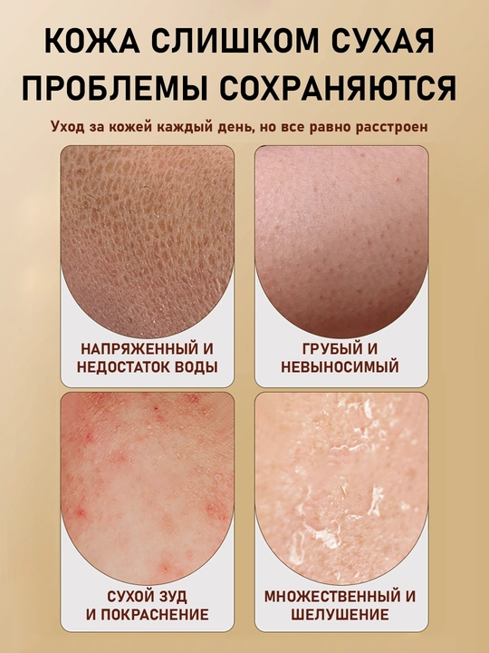 Крем-бальзам, лосьон молочко для тела, увлажняющее, кокосовое, с дозатором, 300 мл