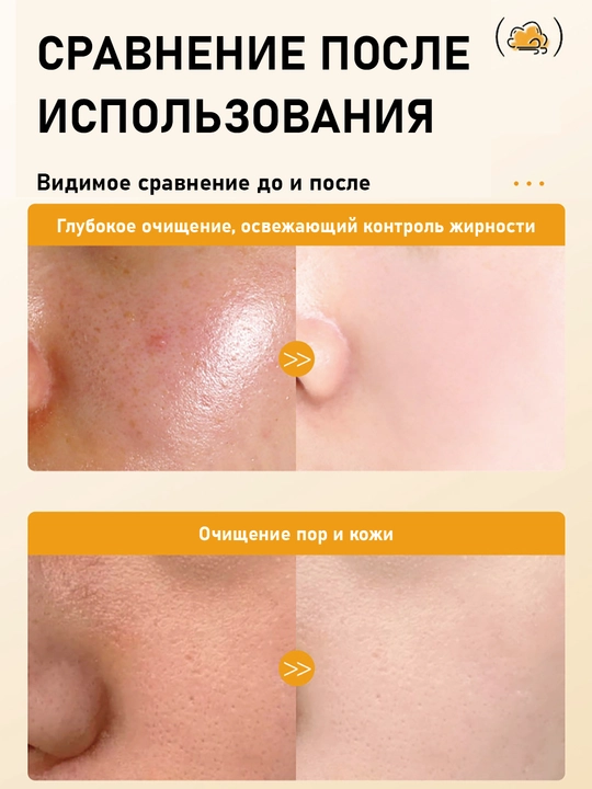 Пенка-мусс для умывания лица, очищающая с массажной щеткой, витамином С, 120 мл