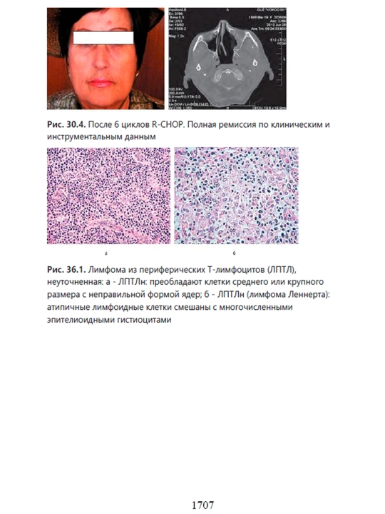 Gematologiya, Chast' 2, Proffesor O.A. Rukavitsyna