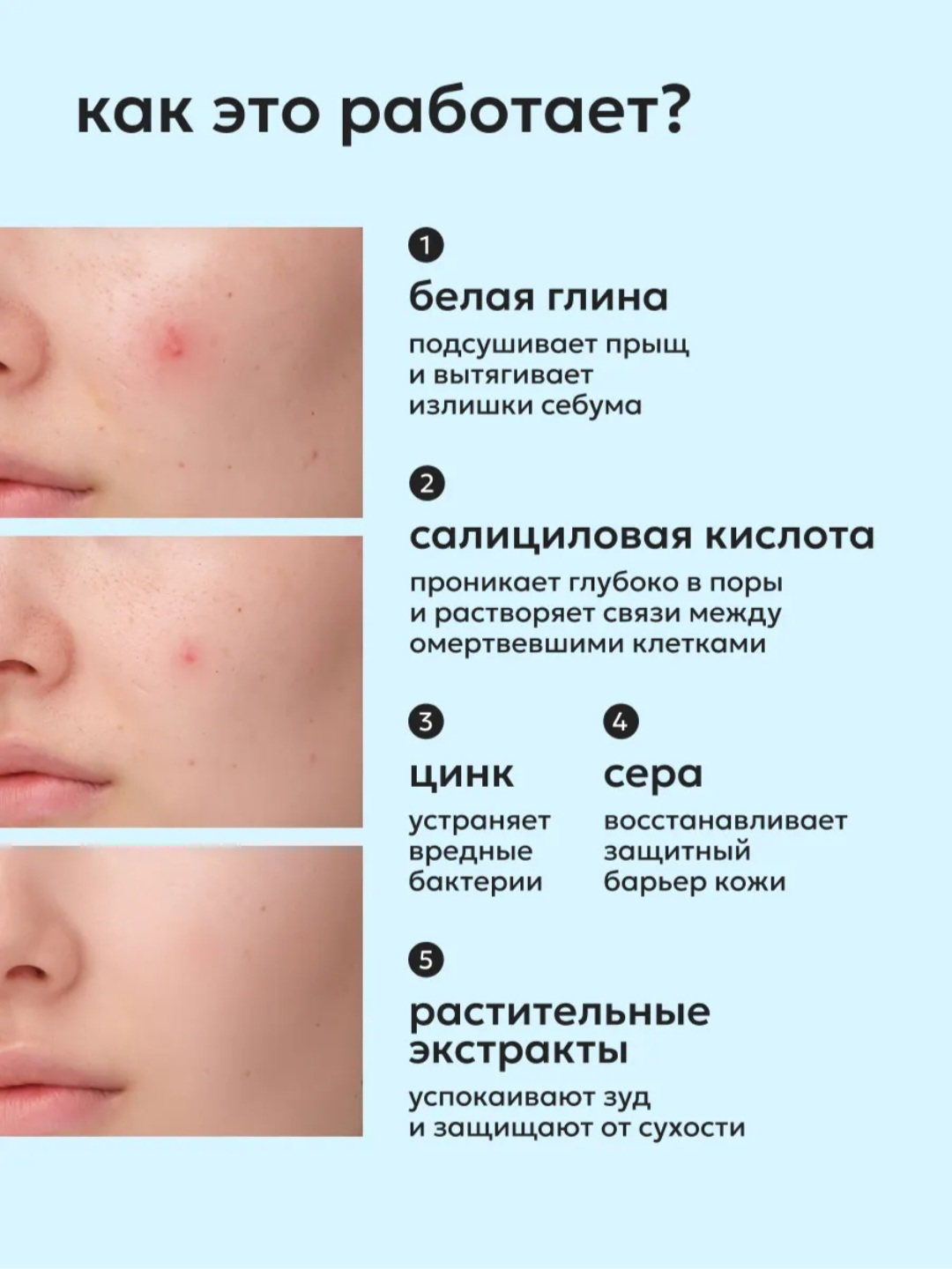 Yuz uchun nuqtaviy surtish kremi SOS akne va ugrilarni davolash uchun, LIKATO, 20 ml